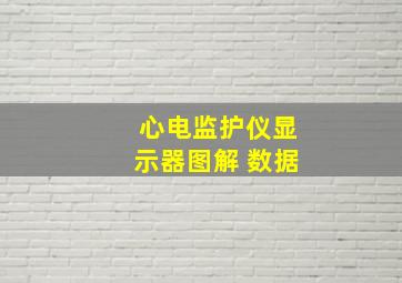 心电监护仪显示器图解 数据